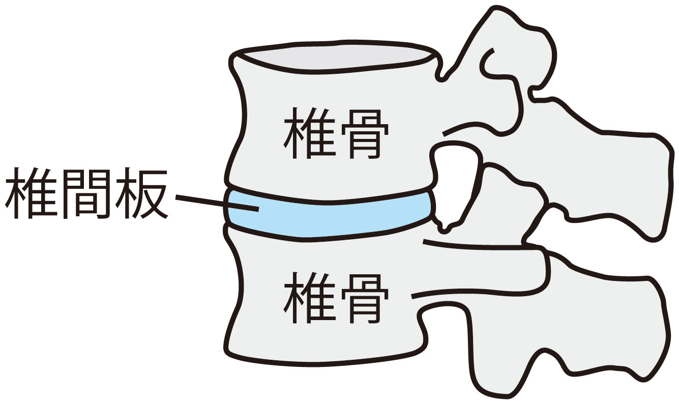 椎骨と椎間板の位置を示した図
